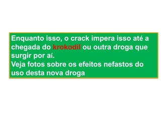 Enquanto isso, o crack impera isso até a
chegada do krokodil ou outra droga que
surgir por aí.
Veja fotos sobre os efeitos nefastos do
uso desta nova droga
 