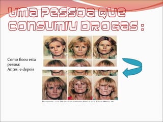 Como ficou esta pessoa: Antes  e depois 