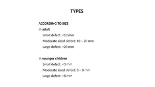 Abc Type Defect Atrial Septal Defect and its overview_SAJAL.pptx