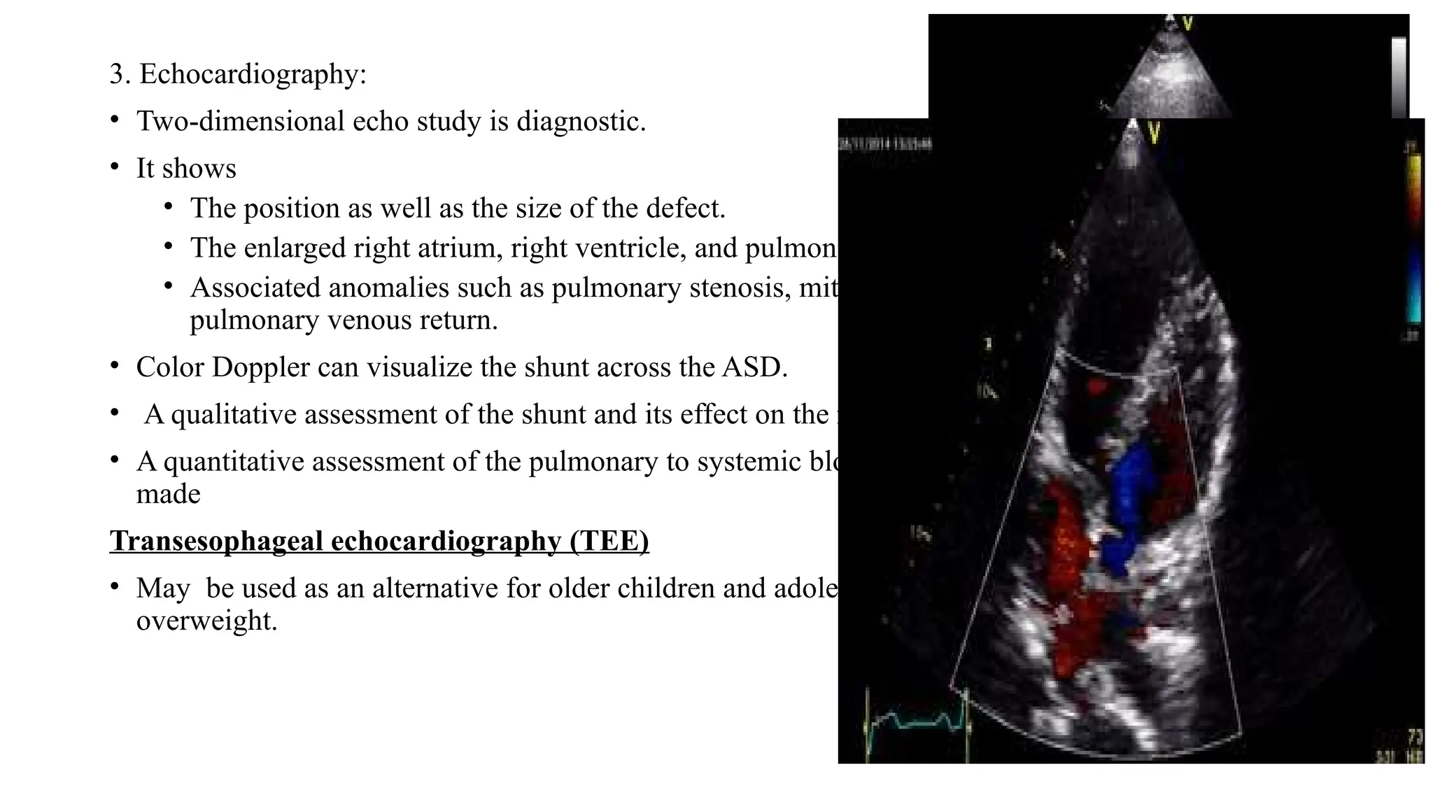 3. Echocardiography:
• Two-dimensional echo study is diagnostic.
• It shows
• The position as well as the size of the defect.
• The enlarged right atrium, right ventricle, and pulmonary arteries.
• Associated anomalies such as pulmonary stenosis, mitral valve prolapse, and anomalous
pulmonary venous return.
• Color Doppler can visualize the shunt across the ASD.
• A qualitative assessment of the shunt and its effect on the right sided cardiac chambers.
• A quantitative assessment of the pulmonary to systemic blood flow ratio (Qp: Qs) also can be
made
Transesophageal echocardiography (TEE)
• May be used as an alternative for older children and adolescents, especially in those who are
overweight.
 