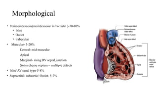 Congenital heart disease - ASD and VSD . | PPTX