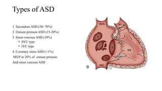 Congenital heart disease - ASD and VSD . | PPTX
