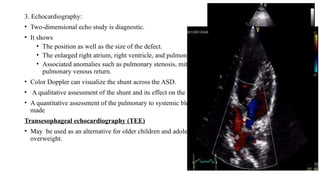 Congenital heart disease - ASD and VSD . | PPTX