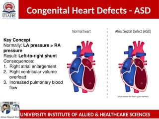Comprehensive Overview of Congenital Heart Defects: ASD and VSD | PPTX