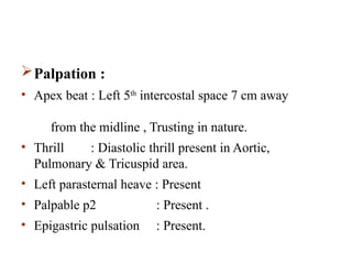 Palpable P2 Case Presentation: A 14 years female patient presented with Fever ...