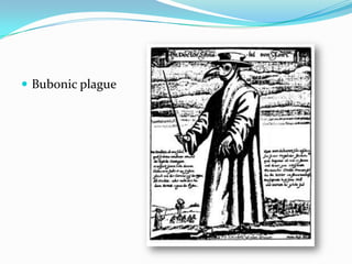  Bubonic plague
 