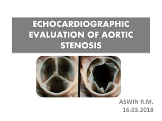 ECHOCARDIOGRAPHIC
EVALUATION OF AORTIC
STENOSIS
ASWIN R.M.
16.03.2018
 