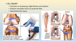 Knee joint assessment | PPTX