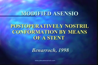 MODIFIED ASENSIO POSTOPERATIVELY NOSTRIL CONFORMATION BY MEANS OF A STENT     Benarroch, 1998 