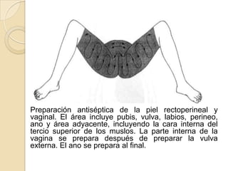 Preparación antiséptica de la piel rectoperineal y
vaginal. El área incluye pubis, vulva, labios, perineo,
ano y área adyacente, incluyendo la cara interna del
tercio superior de los muslos. La parte interna de la
vagina se prepara después de preparar la vulva
externa. El ano se prepara al final.
 