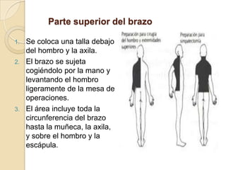Parte superior del brazo
1. Se coloca una talla debajo
del hombro y la axila.
2. El brazo se sujeta
cogiéndolo por la mano y
levantando el hombro
ligeramente de la mesa de
operaciones.
3. El área incluye toda la
circunferencia del brazo
hasta la muñeca, la axila,
y sobre el hombro y la
escápula.
 