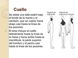 Cuello
1. Se dobla una talla estéril bajo
el borde de la manta y el
camisón, que se vuelve hacia
abajo casi hasta la línea de
los pezones.
2. El área incluye el cuello
lateralmente hasta la línea de
la mesa y hacia arriba hasta la
mandíbula, la parte superior
del hombro y el pecho casi
hasta la línea de los pezones.
 