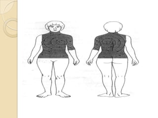 Pecho y troncoÁrea lateral toracoabdominalEl brazo se sujeta durante la preparación.El paciente está en posición lateral.  El área incluye axila, pecho y abdomen desde el cuello hasta la cresta ilíaca. El área se extiende más allá de la línea media, anterior y posteriormente.Comenzando en el punto de la incisión, el área puede incluir la axila, el pecho y el abdomen desde el cuello hasta la cresta ilíaca. Para una preparación quirúrgica en la región renal, se extiende hasta la axila y por abajo hasta el pubis.  El área se extiende también más allá de las líneas medias, anterior y posteriormente, y puede incluir el brazo hasta el codo. 