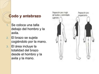 ExtremidadesEl personal sujeta la extremidad llevando guantes estériles y se mantiene elevada hasta que las tallas estériles se apliquen debajo y alrededor del área preparada.Precauciones Evitar que la solución se acumule bajo un torniquete. El empapador absorberá la solución y podría causar maceración de los tejidos. Si se utiliza un torniquete neumático no estéril, se coloca antes de la preparación y protegido bajo una talla de plástico transparente estéril. 
