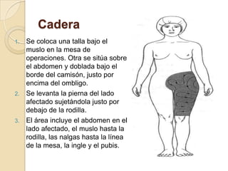 Parte superior del brazoSe coloca una talla debajo del hombro y la axila.El brazo se sujeta cogiéndolo por la mano y levantando el hombro ligeramente de la mesa de operaciones.El área incluye toda la circunferencia del brazo hasta la muñeca, la axila, y sobre el hombro y la escápula.