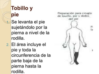 El área incluye abdomen del lado afectado, muslo hasta la rodilla, nalga hasta la línea de la mesa, ingle y pubis.