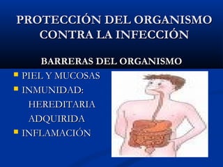 PROTECCIÓN DEL ORGANISMO
   CONTRA LA INFECCIÓN

        BARRERAS DEL ORGANISMO
   PIEL Y MUCOSAS
   INMUNIDAD:
     HEREDITARIA
     ADQUIRIDA
   INFLAMACIÓN
 