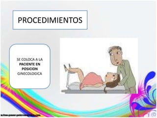 PROCEDIMIENTOS
SE COLOCA A LA
PACIENTE EN
POSICION
GINECOLOGICA
 