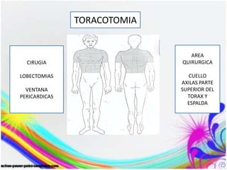 TORACOTOMIA
CIRUGIA
LOBECTOMIAS
VENTANA
PERICARDICAS
AREA
QUIRURGICA
CUELLO
AXILAS PARTE
SUPERIOR DEL
TORAX Y
ESPALDA
 