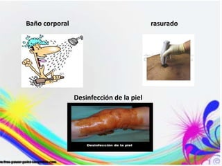rasurado
Baño corporal
Desinfección de la piel
 