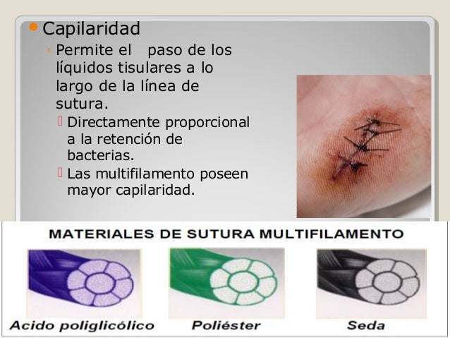 Asepsia y antisepsia suturas