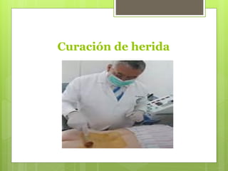 Curación de herida
 