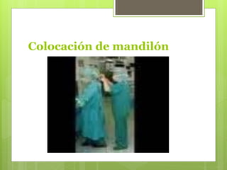 Colocación de mandilón
 