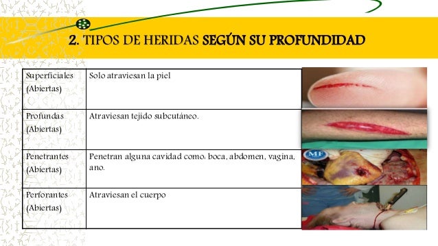 Asepsia y antisepsia, HERIDAS, CICATRIZACIÓN. INFLAMACIÓN 2015