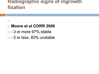 Moore Method Positioning Radiography Aseptic loosening total hip arthroplasty | PPTX