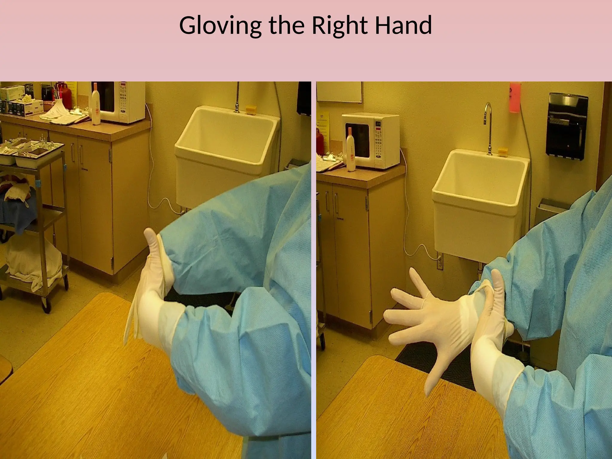 Gloving the Right Hand
 