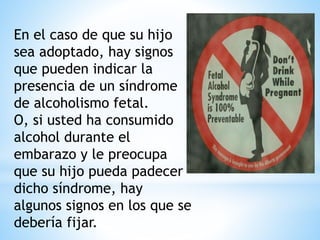En el caso de que su hijo
sea adoptado, hay signos
que pueden indicar la
presencia de un síndrome
de alcoholismo fetal.
O, si usted ha consumido
alcohol durante el
embarazo y le preocupa
que su hijo pueda padecer
dicho síndrome, hay
algunos signos en los que se
debería fijar.
 