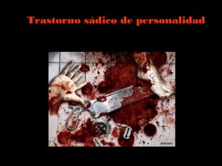 Trastorno sádico de personalidad
 