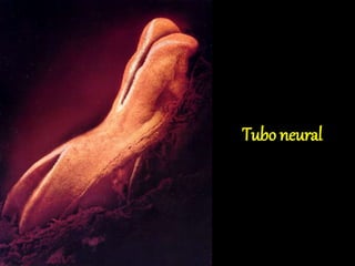 Tubo neural
 