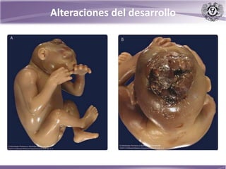 Alteraciones del desarrollo
 