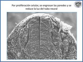 Por proliferación celular, se engrosan las paredes y se
reduce la luz del tubo neural
 