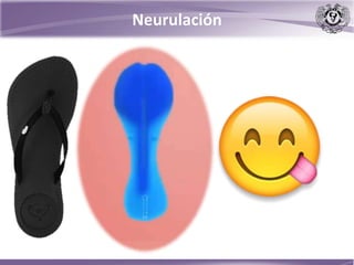 Neurulación
 