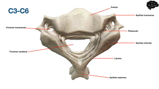 C3-C6
Foramen vertebral
Foramen transversal
Apó
fi
sis espinosa
Apo
fi
sis articular
Apó
fi
sis transversa
Cuerpo
Pedunculo
Lámina
 