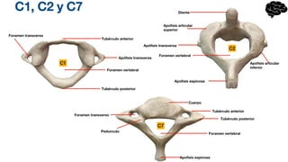 C1, C2 y C7
C1
C7
C2
Apófisis transversa
Tubérculo anterior
Tubérculo posterior
Foramen vertebral
Foramen transverso
Apófisis transversa
Diente
Apofisis espinosa
Foramen vertebral
Apofisis articular
inferior
Apofisis articular
superior
Cuerpo
Foramen transverso
Foramen vertebral
Tubérculo posterior
Apofisis espinosa
Pedunculo
Tubérculo anterior
 