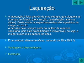 LaqueaçãoLaqueação
 A laqueação é feita através de uma cirurgia, que bloqueia asA laqueação é feita através de uma cirurgia, que bloqueia as
trompas de Falópio (pela secção, cauterização, anéis outrompas de Falópio (pela secção, cauterização, anéis ou
clipes). Deste modo os espermatozóides são impedidos declipes). Deste modo os espermatozóides são impedidos de
chegar ao óvulo.chegar ao óvulo.
A decisão deve sempre partir da mulher de maneiraA decisão deve sempre partir da mulher de maneira
voluntária, pois este procedimento é irreversível, ou seja, avoluntária, pois este procedimento é irreversível, ou seja, a
mulher nunca mais poderá ter filhos.mulher nunca mais poderá ter filhos.
 É um método altamente eficaz, variando de 99 a 99,9 %.É um método altamente eficaz, variando de 99 a 99,9 %.
 Vantagens e desvantagens.Vantagens e desvantagens.
 Ilustração.Ilustração.
 