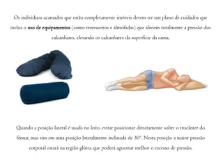 Os indivíduos acamados que estão completamente imóveis devem ter um plano de cuidados que
inclua o uso de equipamentos (como travesseiros e almofadas) que aliviem totalmente a pressão dos
calcanhares, elevando os calcanhares da superfície da cama.

Quando a posição lateral é usada no leito, evitar posicionar directamente sobre o trocânter do
fémur, mas sim em uma posição lateralmente inclinada de 30º. Nesta posição a maior pressão
corporal estará na região glútea que poderá aguentar melhor o excesso de pressão.

 