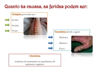 Quanto às causas, as feridas podem ser:
Cirúrgicas provocadas por :
Incisão;
Excisão;
Punção;

Traumáticas devido a agente:
Mecânico;
Químico;
Físico;
Ulcerativas

resultantes de traumatismo ou impedimento do
suprimento sanguíneo.

 