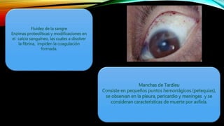 Fluidez de la sangre
Enzimas proteolíticas y modificaciones en
el calcio sanguíneo, las cuales a disolver
la fibrina, impiden la coagulación
formada.
Manchas de Tardieu
Consiste en pequeños puntos hemorrágicos (petequias),
se observan en la pleura, pericardio y meninges y se
consideran características de muerte por asfixia.
 