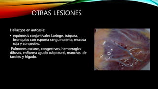 OTRAS LESIONES
Hallazgos en autopsia:
• equimosis conjuntivales Laringe, tráquea,
bronquios con espuma sanguinolenta, mucosa
roja y congestiva,
Pulmones oscuros, congestivos, hemorragias
difusas, enfisema agudo subpleural, manchas de
tardieu y hígado.
 