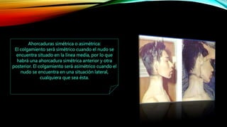 Ahorcaduras simétrica o asimétrica:
El colgamiento será simétrico cuando el nudo se
encuentra situado en la línea media, por lo que
habrá una ahorcadura simétrica anterior y otra
posterior. El colgamiento será asimétrico cuando el
nudo se encuentra en una situación lateral,
cualquiera que sea ésta.
 