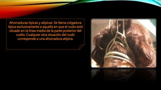 Ahorcaduras típicas y atípicas: Se llama colgadura
típica exclusivamente a aquella en que el nudo está
situado en la línea media de la parte posterior del
cuello. Cualquier otra situación del nudo
corresponde a una ahorcadura atípica.
 