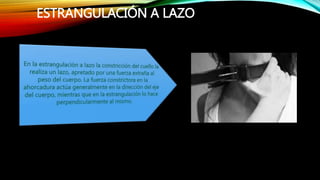 ESTRANGULACIÓN A LAZO
 