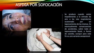 ASFIXIA POR SOFOCACIÓN
 