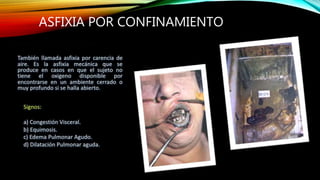 ASFIXIA POR CONFINAMIENTO
 