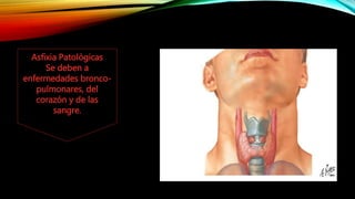 Asfixia Patológicas
Se deben a
enfermedades bronco-
pulmonares, del
corazón y de las
sangre.
 