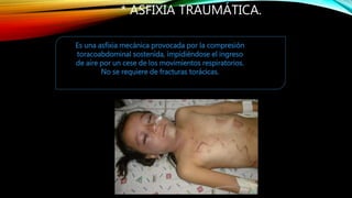 * ASFIXIA TRAUMÁTICA.
Es una asfixia mecánica provocada por la compresión
toracoabdominal sostenida, impidiéndose el ingreso
de aire por un cese de los movimientos respiratorios.
No se requiere de fracturas torácicas.
 